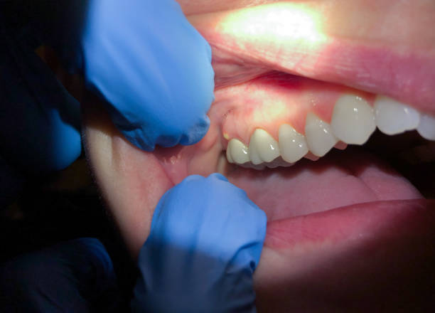 Best Emergency Broken Tooth Repair in Lemoyne, PA